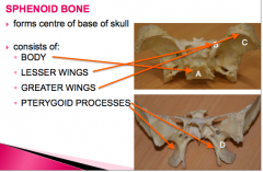 -body
-lesser wings
-greater wings
-pterygoid processes