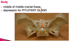 -middle cranial fossa