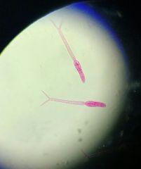 What type of worm is this and what life stage form is it in?