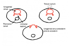 Urogenital sinus endoderm joins the ectoderm after a wound on ectoderm.

Bladder will be facing the outside of the baby's body.