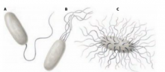 A. Single polar flagellum(monotrichous)
B. Multiple polar flagella(Iophotrichous
C. Flagella arising from all around the cell (peritrichous)