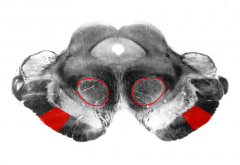 Shown by the 2 red patches (not red circles, these are the red nuclei)