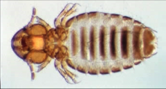 chewing/biting lice- only order that parasitizes birds (also on mammals)
- broad heads (as wide as or wider than thorax)
- pigmented mandibles
- long, filiform antannae (3-5 segments)
- feed on skin, debris, hair, and feathers causing skin irritat...
