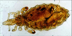 sucking lice- narrow head, not as wide as thorax
- visible antennae
- large, recurved claws
- sucking mouthparts- feed on host blood and tissue
- cause anemia and hypoproteinemia in mammals
- efficient vectors of many diseases