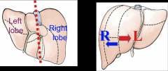 An imaginary line b/e the gallbladder and the IVC through the Liver that divides it into Right and Left lobes