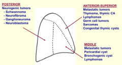 - Metastatic tumors
- Thymoma, thymic cancer
- Lymphomas
- Germ cell tumors
- Sarcomas
- Congenital thymic cysts
