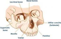 Maxilla bone
Zygomatic bones - form lateral wall of orbits
Lacrimal bones- located in the medial orbital walls
Nasal bones- form bridge of nose 
Inferior nasal conchae - thin curbed bones that project medially and form the lateral walls of the nas...