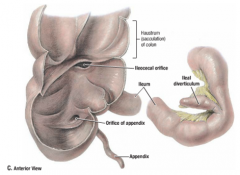 location: distal 3/5 of small intestine, right lower quadrant,  opens into the large intestine at ileocecal junction
*may contain ileal (Meckel's) diverticulum