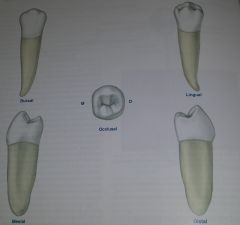 what tooth is this?