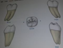 what tooth is this?