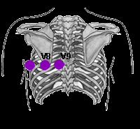 V7- linha axilar posterior 
v8- linha hemiclavicular posterior a baixo da escapula