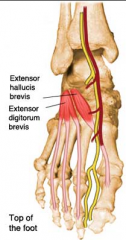 Dorsal layer 
• Extensor hallucis brevis (EHB) 
• Extensor digitorum brevis (EDB) 
• Only intrinsic muscles located in the dorm of the foot 
• Both share a common origin