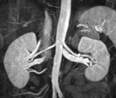 1. This is a ________ of the RENAL ________ and __________.


 


2. _____'s are useful for assessing _______ ________ and pathology related to them.