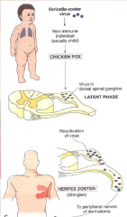Infectious Viral Diseases: Chickenpox to Shingles: Order and Differences