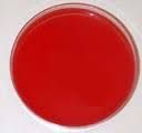 Blood agar or Blood agar plate 