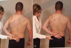 -identifies subscapularis tear or weakness


-same position as lift-off test


-except arm is passively lifted off Low back and pt asked to hold position


(+) = hand moves toward the back/cannot hold position indicating weakness or pain in SUBscap