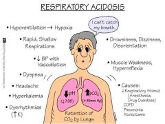 *Acidosis = hypoventilation
-pH < 7.35 and PaCO2 is >42 mmHg
-Inadequate excretion of CO2 w/ inadequate ventilation, resulting in elevated plasma CO2 concentrations and increased levels of carbonic acid.


