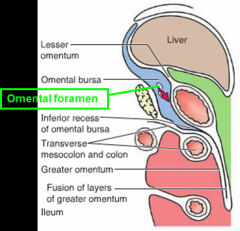 communication btwn greater peritoneal sace & omental bursa

Bound:
anteriorly- hepatoduodenal ligament
posteriorly- inferior vena cava
superiorly- caudate lobe of liver
inferiorly- superior (first) part of duodenum