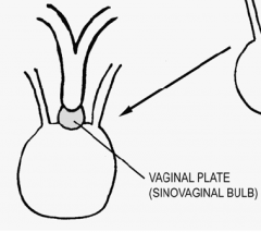 The sinovaginal bulb or vaginal plate