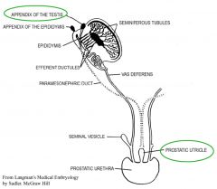 Uterovaginal primordium ---> Prostatic utricle 

Cranial end of
the paramesonephric ducts ---> appendix of testis