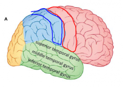Label the highlighted gyri