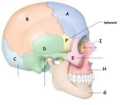 Which of the following is the Parietal bone?
A. a
B. b
C. c
D. d