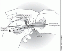 -test for tears of Ulnar collat ligament 


-examiner stabilizes 1st metacarpal 


-takes thumb into extension 


-and applies valgus stress to MCP (pushing proximal phalange of thumb laterally)


(+) for complete tear of ulnar collateral = >30...