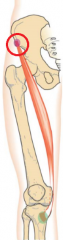 anterior superior iliac spine (ASIS)