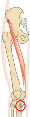 proximal medial aspect of tibia
(longest muscle in the hip)