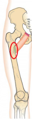 pectineal line of femur