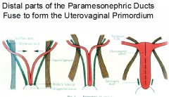 Paramesonephric ducts ---> Uterine tubes

 Uterovaginal primordium ---> Uterus