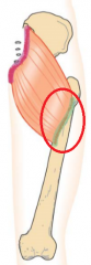 posterior femur distal to greater trochanter & to iliotibial band