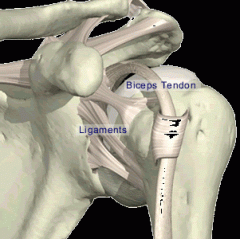 asynchronous firing of the rotator cuff mm may cause subacromial impingement