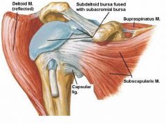 subacromial bursa which is fused with subdeltoid bursa


-palpable by extending humerus


-located over bicipital groove under the deltoid mm


-separates deltoid from RC


-injury=bursitis & shoulder tenderness and restriction of movement