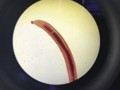 worm like and has a probascis
ph. acanthocephala 