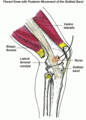 -irritation caused by the rubbing of the ITB over the lateral epicondyle of the femur
-often occurs as overuse injury in runners 
-differential dx: 
1. (+) Ober's 
2. Excessive hip IR in stance
3. Palpation over ITB insertion 
4. Positive Noble co...