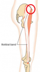 anterior superior iliac spine (ASIS)