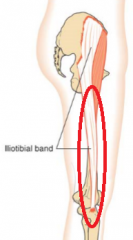lateral condyle of tibia via iliotibial band