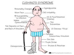 Cushing's Syndrome
NOT type two diabetes
NOT Addison's disease
NOT hypoparathyroidism