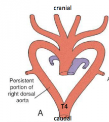 Cranial to T4
Two arches instead of one
Due to the Right Dorsal Aorta not degenerating as it should normally