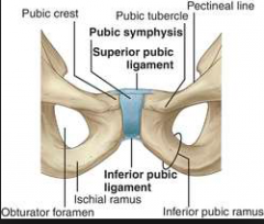 Pubic symphysis  


• Articulation between the two pubic bones with a fibrocartilaginousdisc between 


 • Supported by the superior and inferior pubic ligaments 


• Allow sliding and gliding movements