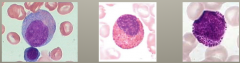 More cytoplasm, less nucleus
Cytoplasm less blue, slight pinkish hue
Specific or secondary granules (harder to see)
Percent in BM = 5-20%
N:C ratio: ~2:1
Left image = neutrophil. Has slightly lighter area near top right that helps ID it . Most we ...