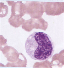 Is this a band neutrophil or a metamyelocyte?