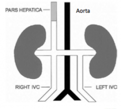 Inferior portion of left supra cardinal persists

Left IVC ends at left renal vein, and joins right IVC