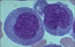 Indented or folded nucleus
Nucleoli
N:C ~4:1 to 2:1
Not easy to ID
Monoblast
Promonocyte
Monocyte
Macrophage

