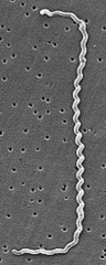 "Corkscrew" shaped bacteria