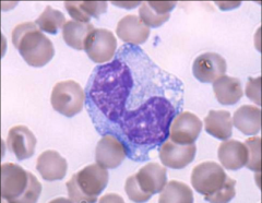 N:C ~2 or 1:1
Irregular nucleus 
Big phagocytes - see lots of vacuoles
Fairly easy to ID
Large irregular nucleus
Larges normal cell in peripheral blood
Monoblast
Promonocyte
Monocyte
Macrophage

