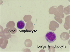 Mature form comes in different sizes (small, medium, large)
N:C ratio will vary
Reported as lymphocytes only (can't distinguish as B or T)
Population varies with age
Xerophilic granules - reddish staining, sometimes seen