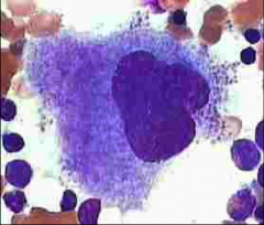 Not really distinguished as a separate stage

Membrane ruptures 

Cytoplasm fragments

Start to get platelets

Stages:
Megakaryoblast
Promegakaryocyte
Megakaryocyte
(budding megakaryocyte)
Platelet
