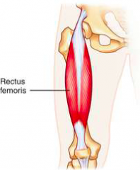 Origin
 SH: AIIS RH: Ilium


 Insertion
Quadriceps tendon 


 Action
Hip flexion Knee extension 


 Innervation
Femoral nerve